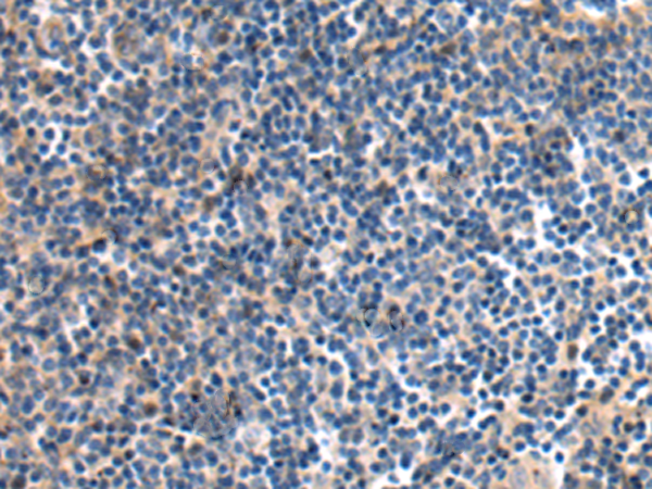 Anti-DNAJB8 Rabbit Polyclonal Antibody