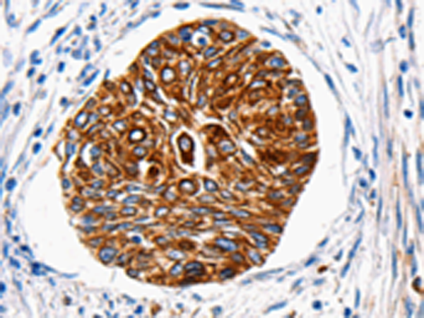 Anti-HTR1A Rabbit Polyclonal Antibody