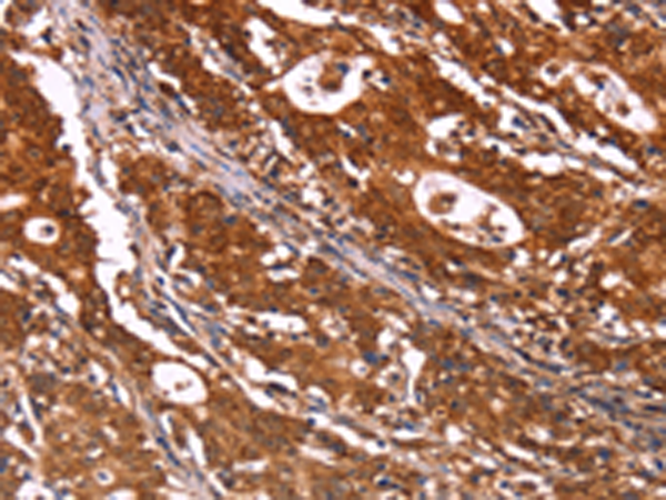 Anti-ABI1 Rabbit Polyclonal Antibody