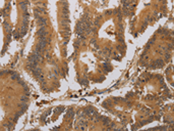 Anti-ACHE Rabbit Polyclonal Antibody