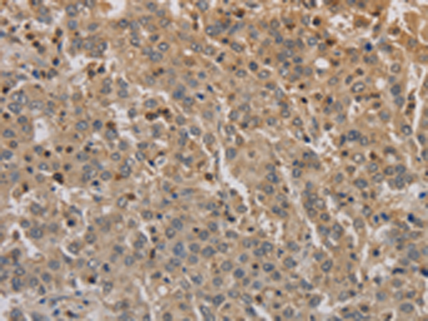 Anti-ADO Rabbit Polyclonal Antibody