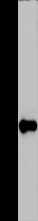 Anti-ADO Rabbit Polyclonal Antibody