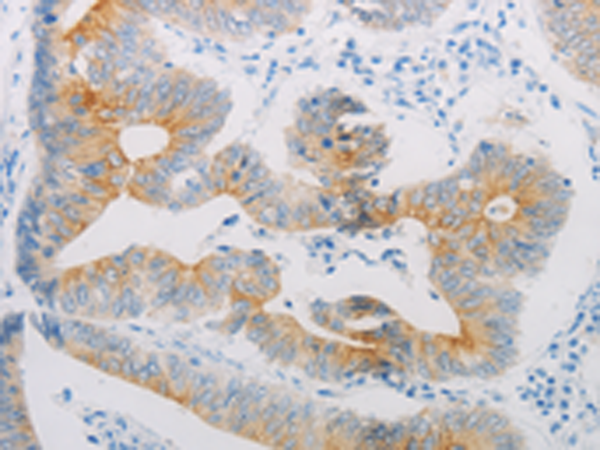 Anti-beta 2 Adrenergic Receptor Rabbit Polyclonal Antibody