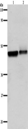 Anti-beta 2 Adrenergic Receptor Rabbit Polyclonal Antibody