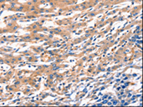 Anti-Rab18 Rabbit Polyclonal Antibody