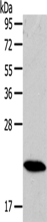 Anti-Rab18 Rabbit Polyclonal Antibody