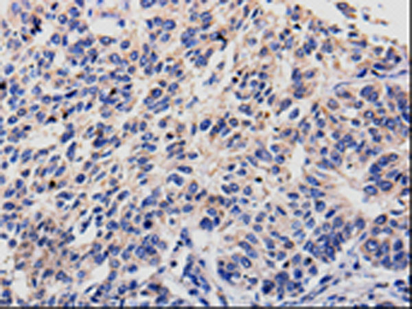 Anti-Rab22A Rabbit Polyclonal Antibody