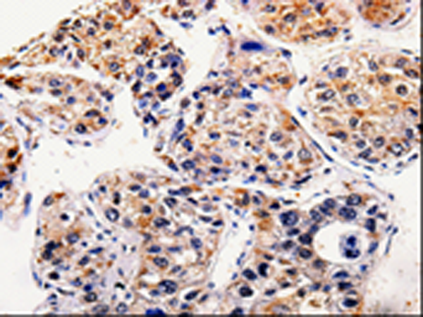 Anti-AP1B1 Rabbit Polyclonal Antibody