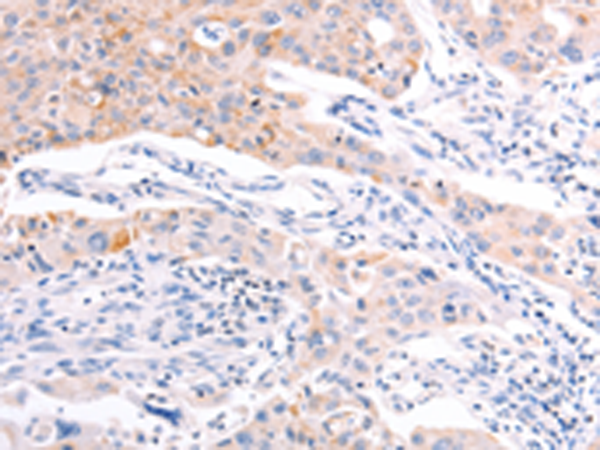 Anti-RALA Rabbit Polyclonal Antibody
