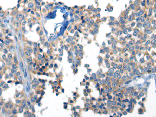 Anti-LOX Rabbit Polyclonal Antibody