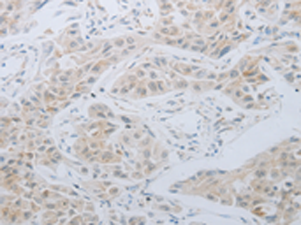 Anti-LOX Rabbit Polyclonal Antibody