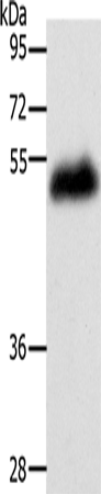 Anti-LOX Rabbit Polyclonal Antibody
