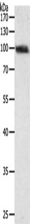 Anti-PYGB Rabbit Polyclonal Antibody