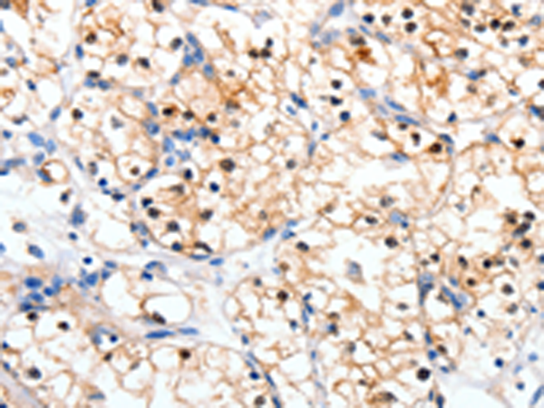 Anti-RALB Rabbit Polyclonal Antibody