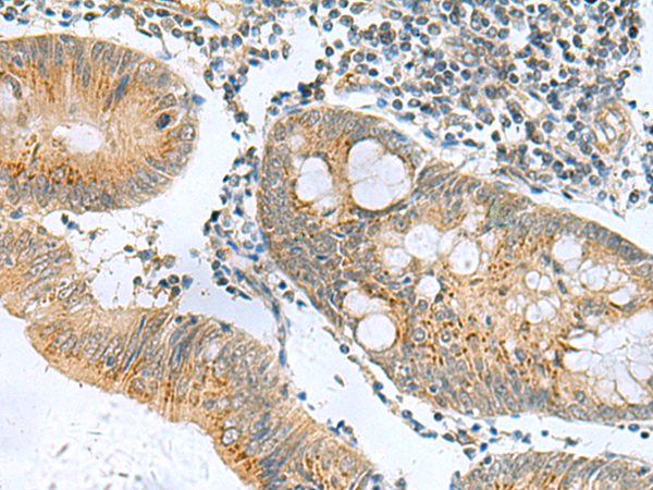 Anti-TIM 1 Rabbit Polyclonal Antibody