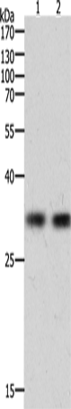 Anti-TIM 1 Rabbit Polyclonal Antibody