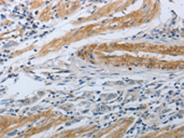 Anti-NPR1 Rabbit Polyclonal Antibody