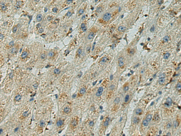 Anti-ADAMTS5 Rabbit Polyclonal Antibody