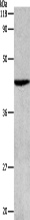 Anti-ATG4B Rabbit Polyclonal Antibody