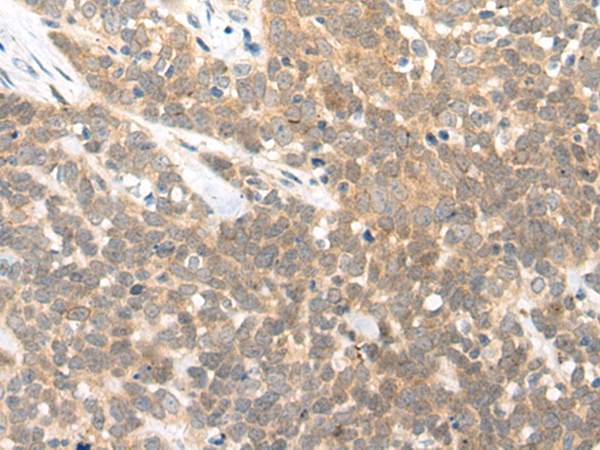 Anti-FGF3 Rabbit Polyclonal Antibody