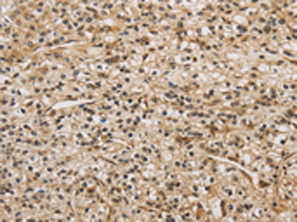 Anti-BRAF Rabbit Polyclonal Antibody
