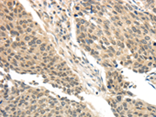 Anti-BRCA2 Rabbit Polyclonal Antibody