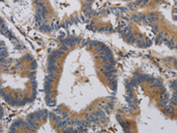 Anti-CCR2 Rabbit Polyclonal Antibody