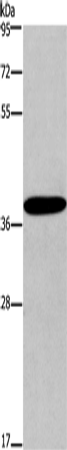Anti-CCR2 Rabbit Polyclonal Antibody
