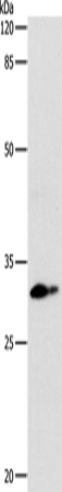 Anti-CEBPD Rabbit Polyclonal Antibody