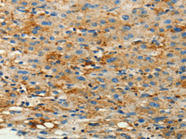 Anti-CFTR Rabbit Polyclonal Antibody