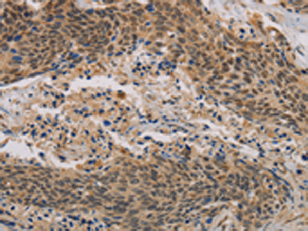 Anti-CLEC5A Rabbit Polyclonal Antibody