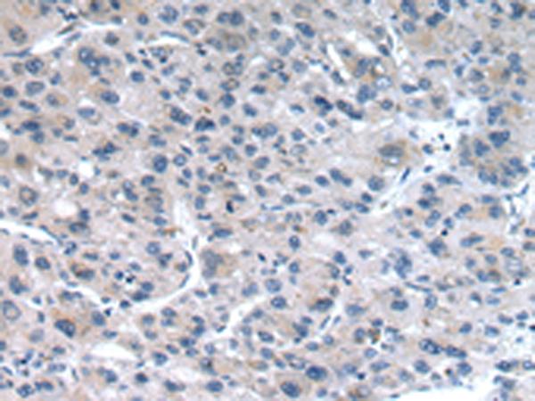 Anti-Claudin 19 Rabbit Polyclonal Antibody