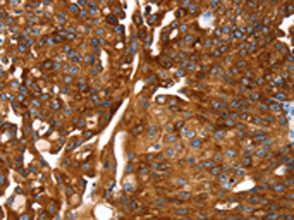 Anti-Cyclooxygenase 1 Rabbit Polyclonal Antibody