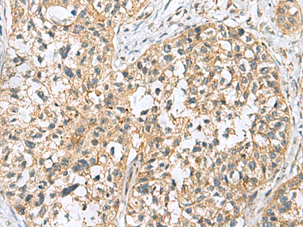 Anti-SKI Rabbit Polyclonal Antibody