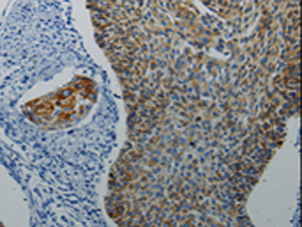 Anti-Dopamine Receptor D4 Rabbit Polyclonal Antibody