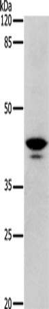 Anti-Dopamine Receptor D4 Rabbit Polyclonal Antibody