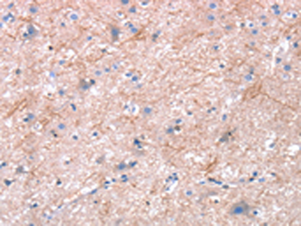 Anti-DAP3 Rabbit Polyclonal Antibody