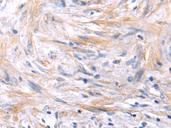 Anti-DMBT1 Rabbit Polyclonal Antibody