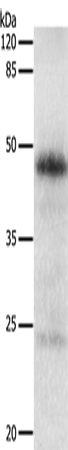 Anti-EDA Rabbit Polyclonal Antibody