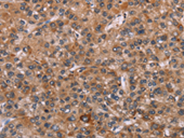 Anti-EGR4 Rabbit Polyclonal Antibody