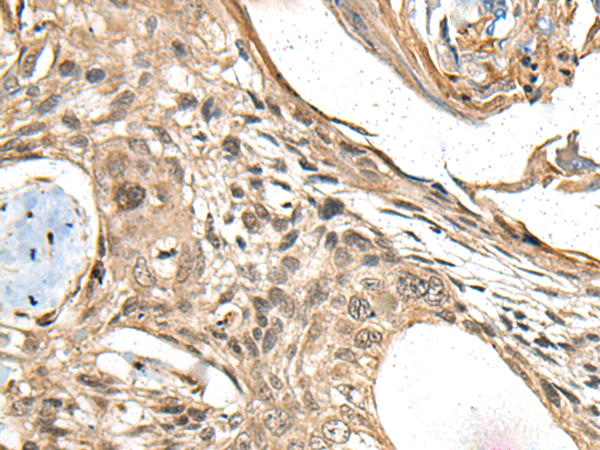 Anti-MAPK4 Rabbit Polyclonal Antibody
