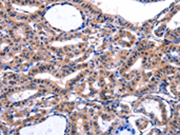 Anti-FBN1 Rabbit Polyclonal Antibody