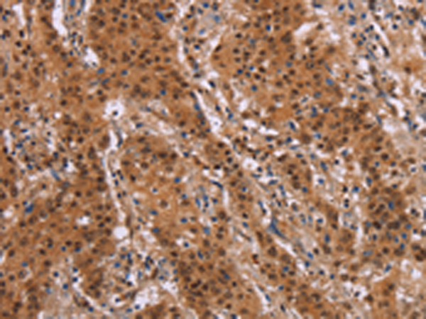 Anti-FRA1 Rabbit Polyclonal Antibody
