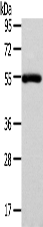 Anti-FOXC1 Rabbit Polyclonal Antibody