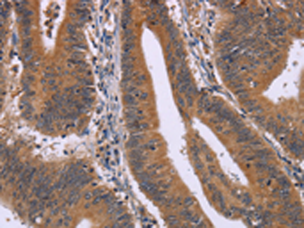 Anti-CMTM6 Rabbit Polyclonal Antibody