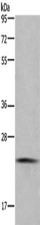 Anti-CMTM6 Rabbit Polyclonal Antibody
