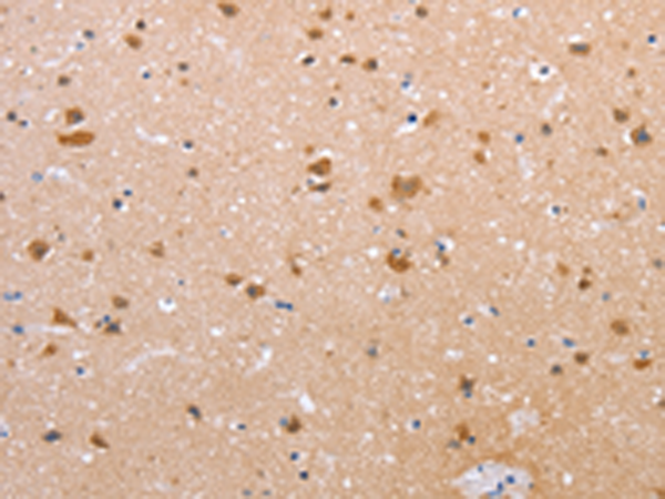 Anti-Claudin 10 Rabbit Polyclonal Antibody