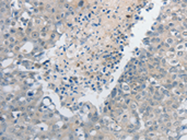 Anti-GCH1 Rabbit Polyclonal Antibody