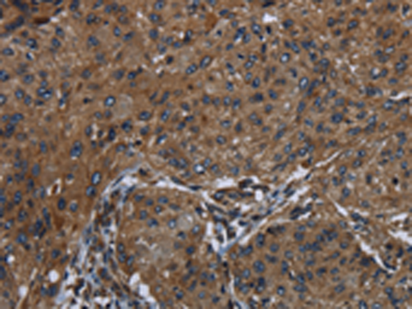 Anti-HOXC8 Rabbit Polyclonal Antibody