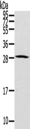 Anti-HOXC8 Rabbit Polyclonal Antibody